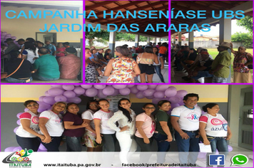 Foto - SAÚDE HANSENÍASE