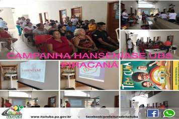 Foto - SAÚDE HANSENÍASE